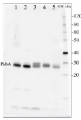 PsbA | D1 protein of PSII, C-terminal (chicken)